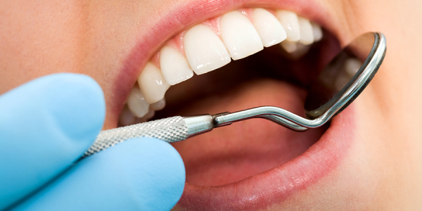 10 علت بدرنگی دندانها و راههای جلوگیری از آنها